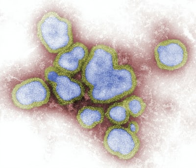 Coronavirus